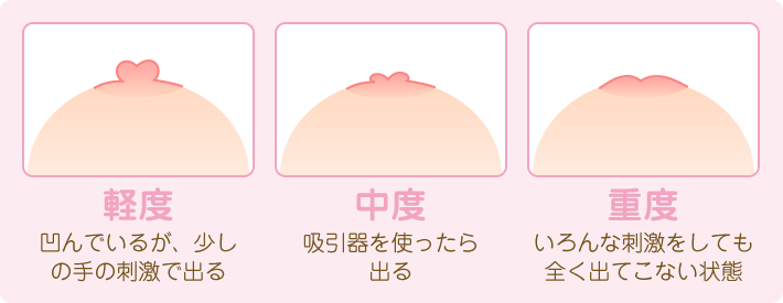 乳首のかゆみは汚れと陥没乳首が原因 ワタシが試したセルフケアは Narumi S Blog Diary