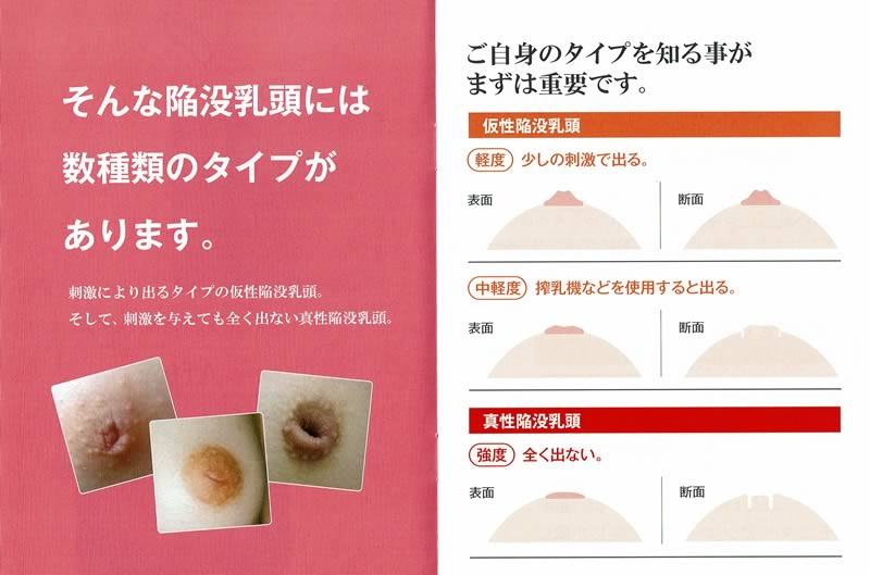陥没乳首の露出度を軽度・中度・重度で解説したピュアナスのパンフレット